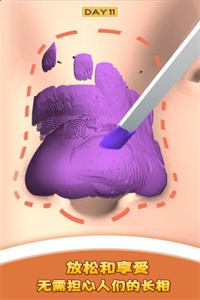 我爱挤黑头游戏
