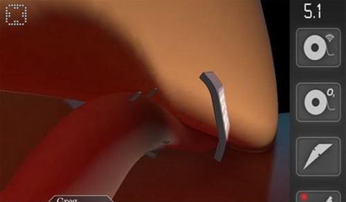 回声迷踪汉化版